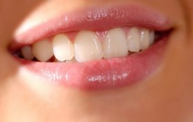 Gražūs dantys
